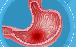 慢性胃炎吃哪些食物好 慢性胃炎可以吃什么