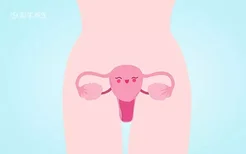 宫颈糜烂怎么造成的原因 诱发宫颈糜烂的5个原因