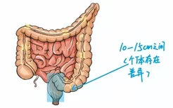 直肠有多少厘米长图片