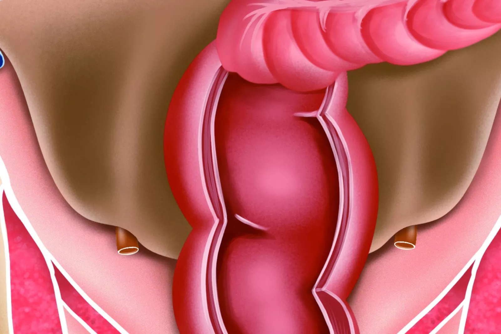 直肠壶腹部解剖图