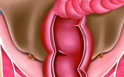 直肠壶腹部解剖图