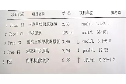 甲减化验单图片