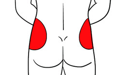 胰岛素臀部注射部位图片