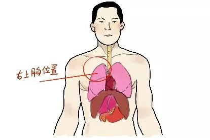 右上胸疼痛部位对照表图片
