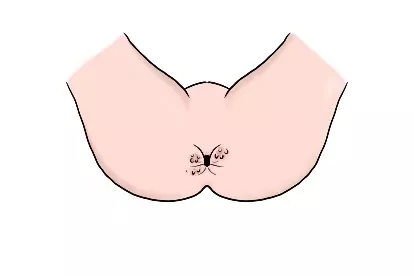 肛周鳞状细胞癌的图片