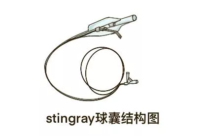 stingray球囊结构图