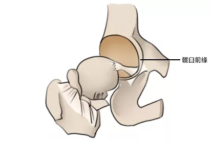 髋臼前缘图片