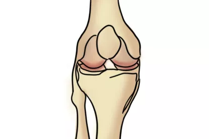 膝盖关节示意图