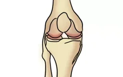 膝盖关节示意图