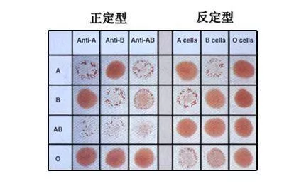 o型血化验单图片