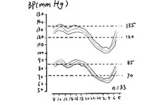 杓型血压曲线图