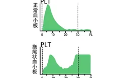 血小板直方图右侧呈拖尾状,mcv低于正常