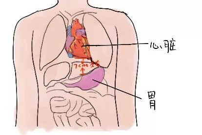 心脏离胃距离图片
