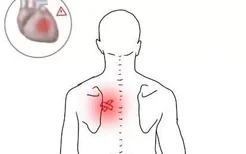 心脏病反射后背疼位置图