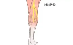 腓总神经高清位置图