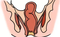 女性正常肛门内部结构图