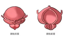 膀胱解剖结构图