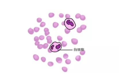 血涂片白细胞图