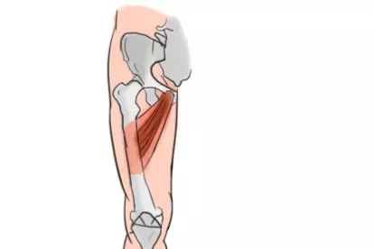 股下肌肉凹陷图片
