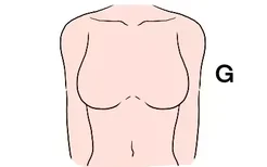 假体隆胸最大的图片