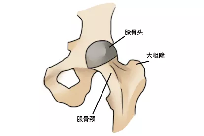 股骨头负重区图