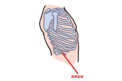 游离肋骨位置图片