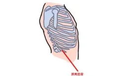 游离肋骨位置图片