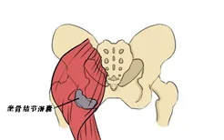 坐骨结节滑囊位置解剖图