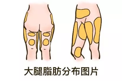 大腿脂肪分布图