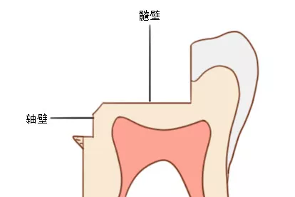 髓壁和轴壁图片