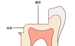 髓壁和轴壁的区别图片