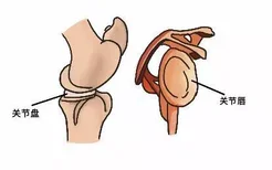 关节盘和关节唇图片