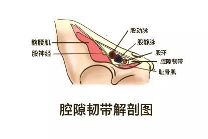 腔隙韧带解剖图