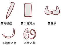 超肋假体图片