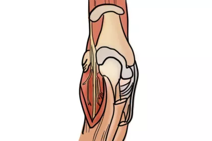 肱骨髁解剖图
