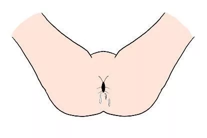 肛门后沟分泌物图