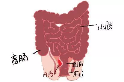 肠道内痔结构图