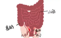 人体肠道内痔结构图