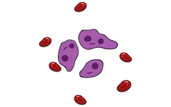 瑞氏染色图片中靶形红细胞增多常见于