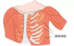 胸背神经解剖图