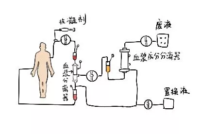 双重血浆置换图