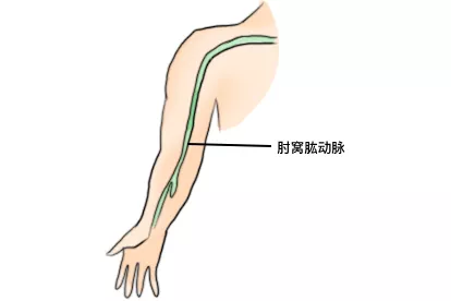 肘窝肱动脉位置图