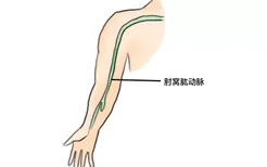 肘窝肱动脉位置图