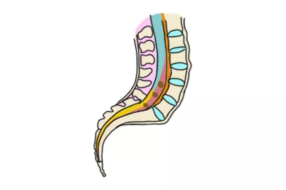 骨髓栓系图片