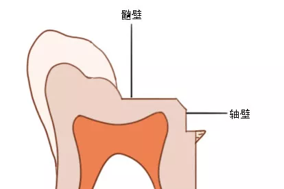 髓壁和轴壁图片