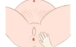 孕妇痔疮按摩哪个部位图
