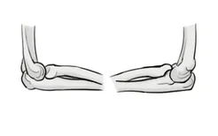 肱骨和尺骨桡骨示意图