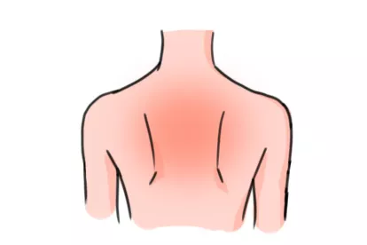 上背部疼痛图片