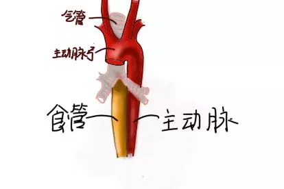 食管和主动脉的位置图