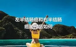 左半结肠癌和右半结肠癌的预后如何